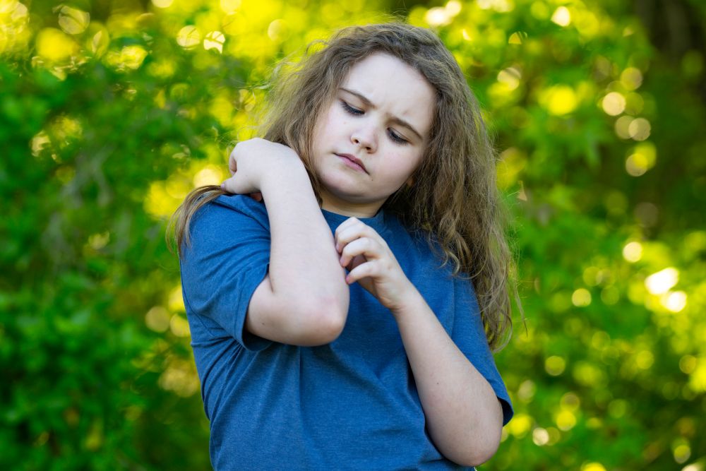 BooBoo-Lytes™ for Summer Burns, Bug Bites & Rashes